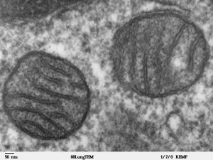 Een moeder geeft deze mitochondriën aan haar kind door. Bij het syndroom van Leigh is een van de genen die hierin zit gemuteerd. Beeld: Wikimedia Commons