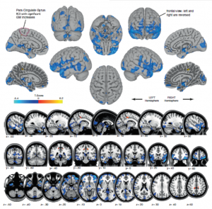 astronauts-brains-change-shape-during-spaceflight-orig1-20160131