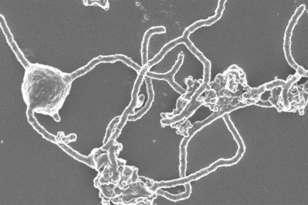 Al het complexe leven, de eukaryoten, stamt misschien af van één groep eencellige organismen: de Asgard-archaea.